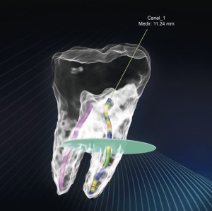 MÓDULO TOMOGRÁFICO DE ENDODONCIA