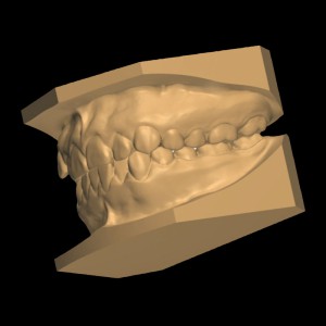 MODELOS DIGITALES 3D DICOM