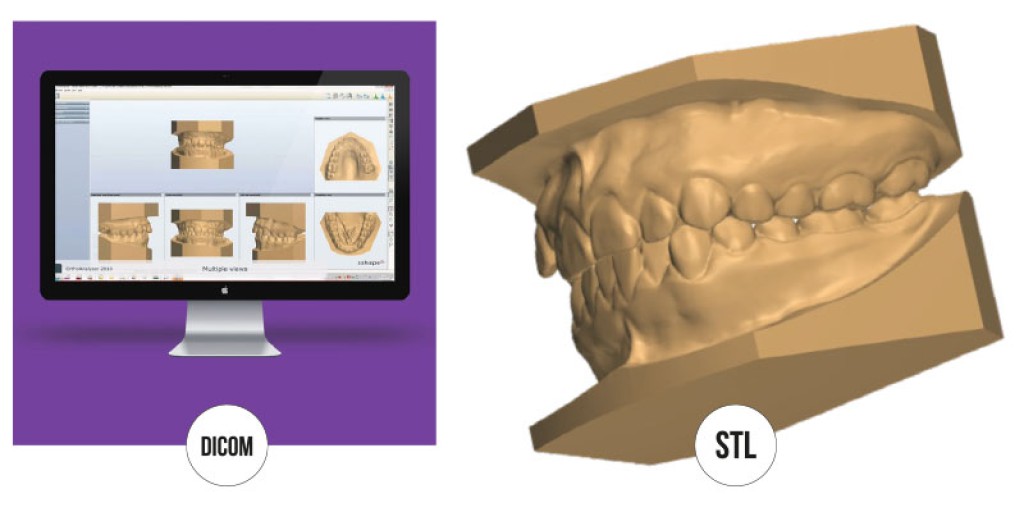 MODELOS DIGITALES 3D DICOM