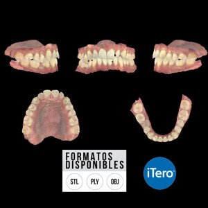 ESCANEO INTRAORAL ITERO