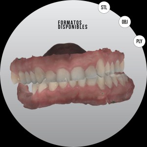 ESCANEO INTRAORAL