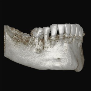 FOV 5x8