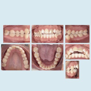 FOTOGRAFÍA INTRAORAL